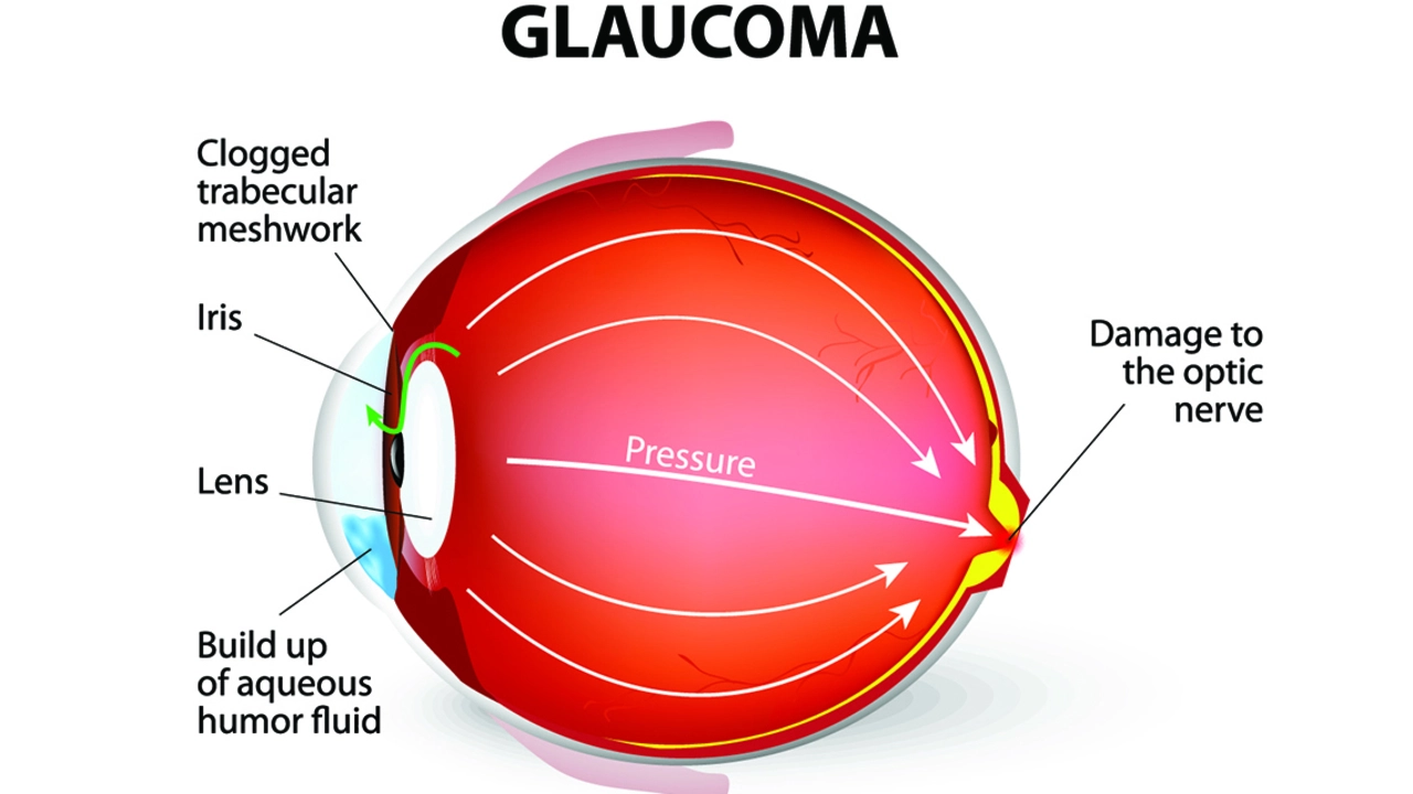 Dipyridamole and its potential role in the treatment of glaucoma
